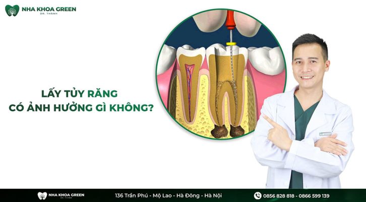 Lấy tủy răng có ảnh hưởng gì không?