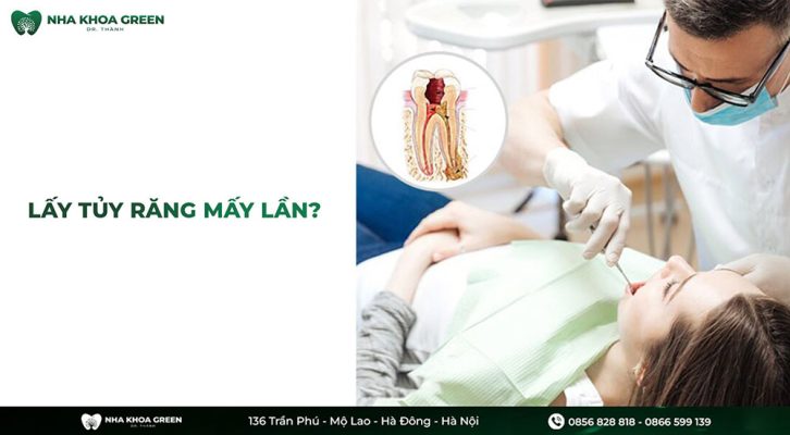 Lấy tủy răng mấy lần mới xong và quy trình lấy tủy răng nhiều lần