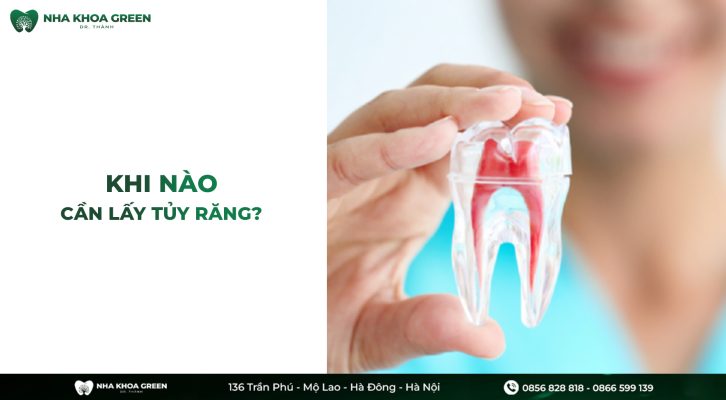 Khi nào cần lấy tủy răng? Cách chăm sóc răng miệng sau khi lấy tủy