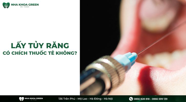 Quá trình lấy tủy răng có chích thuốc tê không?