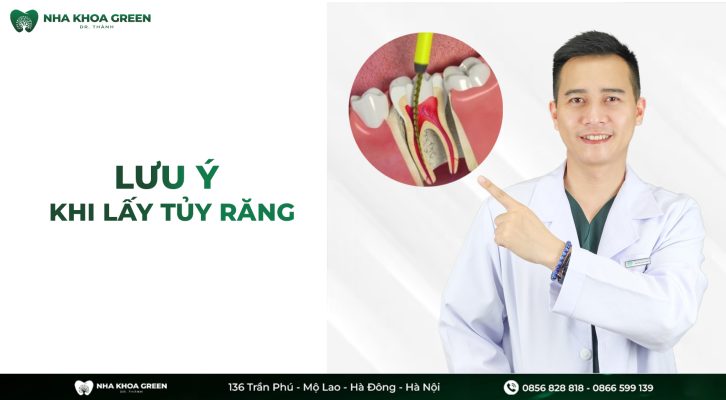Những điều cần lưu ý khi lấy tủy răng có thể bạn chưa biết