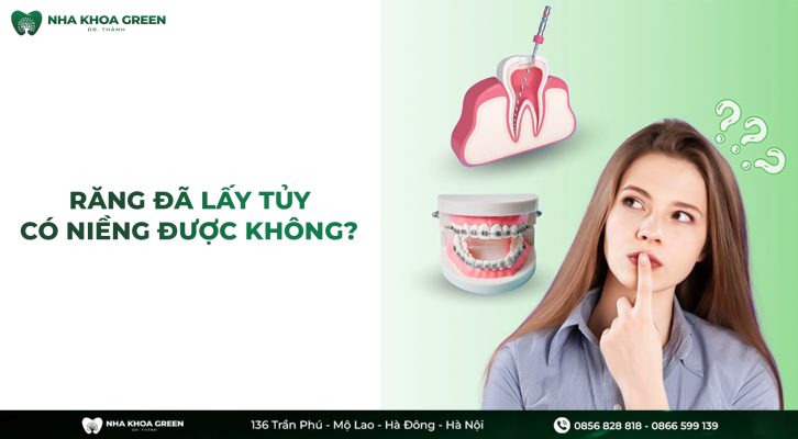 Răng đã lấy tủy có niềng được không? - Chuyên gia giải đáp