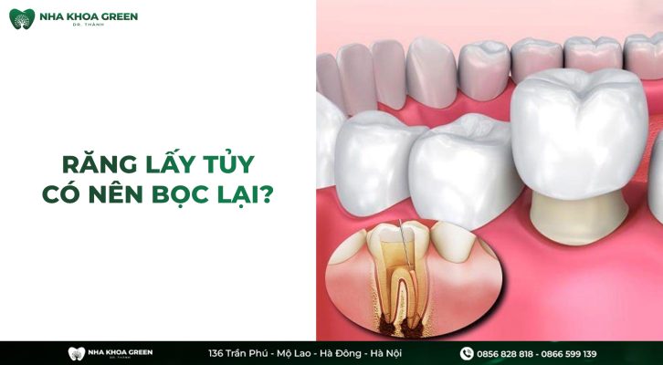 Răng lấy tủy có nên bọc lại không?