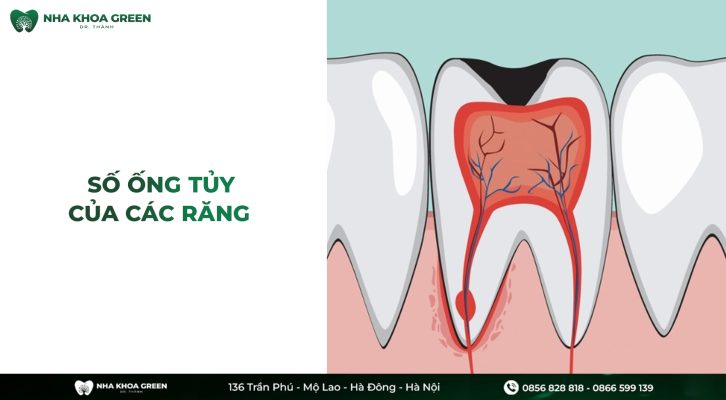 Số ống tủy của các răng là bao nhiêu?